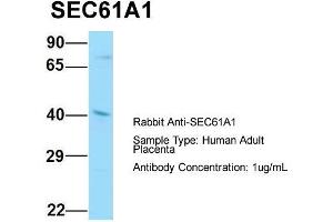 Host: Rabbit  Target Name: SEC61A1  Sample Tissue: Human Adult Placenta  Antibody Dilution: 1. (SEC61A1 anticorps  (C-Term))