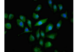 Immunofluorescent analysis of A549 cells using ABIN7146640 at dilution of 1:100 and Alexa Fluor 488-congugated AffiniPure Goat Anti-Rabbit IgG(H+L) (ABCC3 anticorps  (AA 827-953))