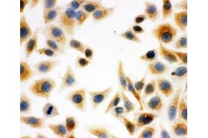 ICC testing of HeLa cells (DCI anticorps  (C-Term))