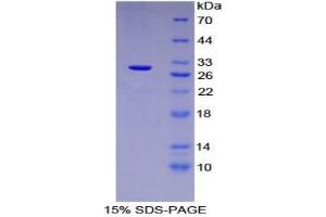 SDS-PAGE analysis of Mouse Tubulin beta 6 Protein.