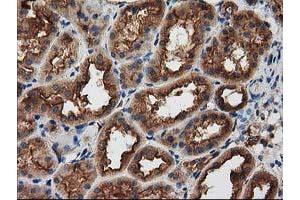 Immunohistochemical staining of paraffin-embedded Human Kidney tissue using anti-PRKAR2A mouse monoclonal antibody.