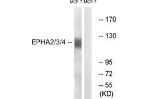Western blot analysis of extracts from MCF-7 cells, using EPHA2/3/4 (Ab-588/596) Antibody. (EPHA2/3/4 anticorps  (AA 556-605))