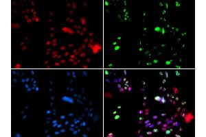 Immunofluorescence analysis of GFP-RNF168 transgenic U2OS cells using PI antibody (ABIN6128449, ABIN6145593, ABIN6145595 and ABIN6221396).