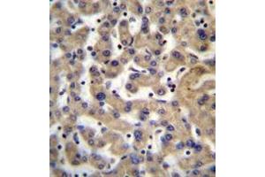 Immunohistochemistry analysis in formalin fixed and paraffin embedded human liver tissue reacted with PDP1 Antibody (Center) followed by peroxidase conjugation of the secondary antibody and DAB staining. (PDP anticorps  (Middle Region))