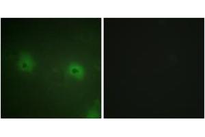Immunofluorescence analysis of HuvEc cells, using STAM2 (Ab-192) Antibody.