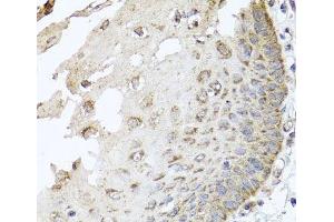 Immunohistochemistry of paraffin-embedded Human esophagus using IRS2 Polyclonal Antibody at dilution of 1:100 (40x lens). (IRS2 anticorps)