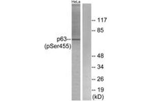 Western blot analysis of extracts from HeLa cells treated with TNF 2500U/ML 30', using p63 (Phospho-Ser455) Antibody. (TCP1 alpha/CCTA anticorps  (pSer455))