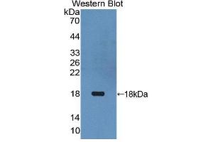Western blot analysis of the recombinant protein. (Thymic Stromal Lymphopoietin anticorps  (AA 29-159))