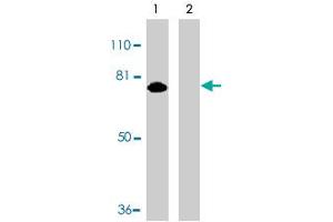 Western blot analysis of MTA2 expression in HeLa whole cell lysates in the absence (lane 1) or presence (lane 2) of blocking peptide with MTA2 polyclonal antibody  at 1 ug /mL . (MTA2 anticorps  (AA 652-668))