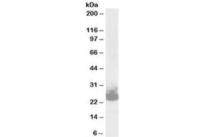 Western blot testing of mouse brain lysate with SNAP25 antibody at 0. (SNAP25 anticorps)