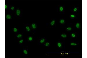 Immunofluorescence of monoclonal antibody to FOXA1 on HeLa cell.
