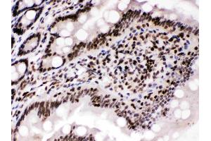 Cyclin T1 was detected in paraffin-embedded sections of rat intestine tissues using rabbit anti- Cyclin T1 Antigen Affinity purified polyclonal antibody (Catalog # ) at 1 µg/mL.