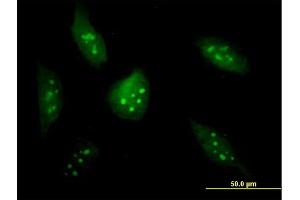 Immunofluorescence of purified MaxPab antibody to BXDC2 on HeLa cell. (BRIX1 anticorps  (AA 1-353))