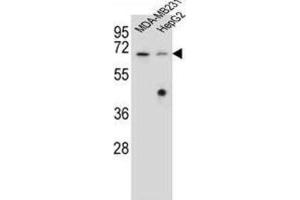 Western Blotting (WB) image for anti-Glomulin, FKBP Associated Protein (GLMN) antibody (ABIN2996511) (GLMN anticorps)