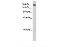 Image no. 2 for anti-Sodium Channel, Voltage-Gated, Type V, alpha Subunit (SCN5A) (AA 1856-1905) antibody (ABIN6736314) (SCN5A anticorps  (AA 1856-1905))