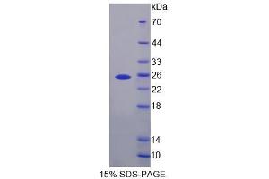 SDS-PAGE analysis of Mouse IHPK3 Protein. (IP6K3 Protéine)