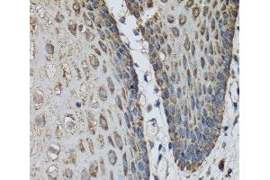Immunohistochemistry of paraffin-embedded Human esophagus using IL36G Polyclonal Antibody at dilution of 1:100 (40x lens). (IL1F9 anticorps)