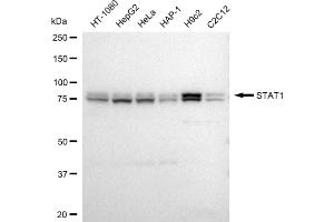 Western blotting analysis using STAT1 antibody (ABIN7800337).