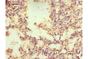 Immunohistochemistry of paraffin-embedded human lung tissue using ABIN7161903 at dilution of 1:100