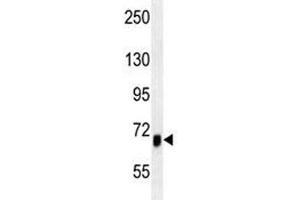 ACVR1B antibody western blot analysis in mouse heart tissue lysate
