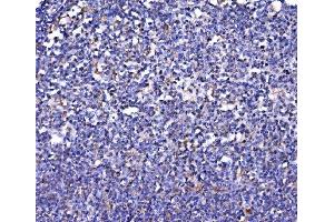 IHC analysis of FKBP135/FKBP15 using anti-FKBP135/FKBP15 antibody (ABIN7600397).