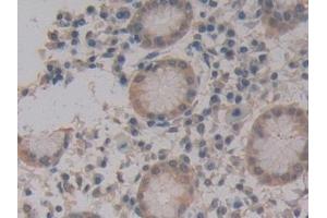 Detection of MPG1 in Human Stomach Tissue using Polyclonal Antibody to Macrophage Expressed Gene 1 Protein (MPG1) (MPEG1 anticorps  (AA 313-580))