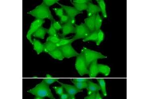 Immunofluorescence analysis of A549 cells using PRKD3 Polyclonal Antibody (PRKD3 anticorps)