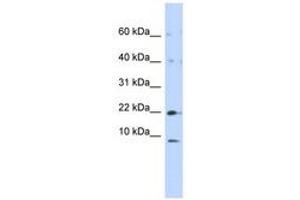 Image no. 1 for anti-NADH Dehydrogenase (Ubiquinone) 1, Subcomplex Unknown, 2, 14.5kDa (NDUFC2) (N-Term) antibody (ABIN6740975)