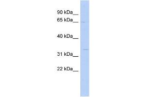 WB Suggested Anti-SC5DL Antibody Titration: 0. (SC5DL anticorps  (N-Term))