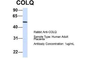 Host:  Rabbit  Target Name:  COLQ  Sample Type:  Human Adult Placenta  Antibody Dilution:  1. (COLQ anticorps  (N-Term))