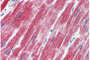 Human Heart (formalin-fixed, paraffin-embedded) stained with TEAD1 antibody ABIN462220 followed by biotinylated goat anti-rabbit IgG secondary antibody ABIN481713, alkaline phosphatase-streptavidin and chromogen.