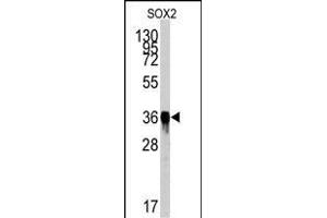 Western blot analysis of SOX2 Antibody (ABIN387798 and ABIN2843854) by SOX2 recombinant protein. (SOX2 anticorps)