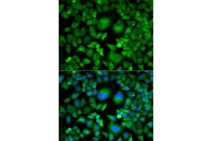 Immunofluorescence analysis of A549 cells using UBE2H antibody. (UBE2H anticorps  (AA 1-183))