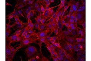 Immunofluorescence (IF) image for anti-CD68 Molecule (CD68) antibody (ABIN2664804) (CD68 anticorps)