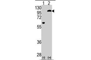 Western blot analysis of PRKCE (arrow) using rabbit PRKCE polyclonal antibody . (PKC epsilon anticorps  (AA 213-243))