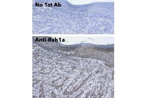 Immunohistochemistry (IHC) image for anti-RAB1A, Member RAS Oncogene Family (RAB1A) (C-Term) antibody (ABIN7272978)