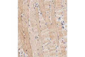 Immunohistochemical analysis of paraffin-embedded human skeletal muscle tissue using (ABIN656961 and ABIN2846145) performed on the Leica® BOND RXm. (CLMP anticorps  (AA 81-110))