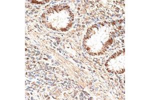 Immunohistochemistry of paraffin-embedded human appendix using MCM5 antibody.