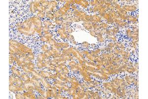 ABIN7094699 and ABIN7098750 at 1/100 staining Mouse kidney tissue by IHC-P.