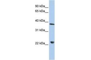 Image no. 1 for anti-DEAD (Asp-Glu-Ala-Asp) Box Polypeptide 25 (DDX25) (AA 180-229) antibody (ABIN6742679) (DDX25 anticorps  (AA 180-229))