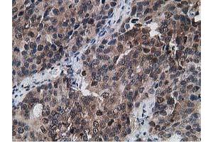 Image no. 3 for anti-Gephyrin (GPHN) antibody (ABIN1498424)