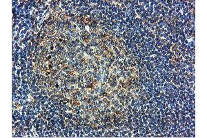 Image no. 8 for anti-IlvB (Bacterial Acetolactate Synthase)-Like (ILVBL) antibody (ABIN1498878) (ILVBL anticorps)