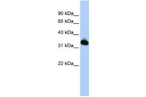 Western Blotting (WB) image for anti-Galactose Mutarotase (Aldose 1-Epimerase) (GALM) antibody (ABIN2459553) (GALM anticorps)