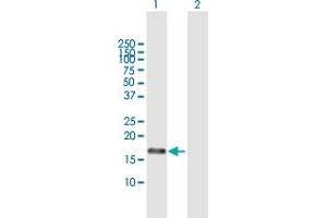 Western Blot analysis of RFK expression in transfected 293T cell line by RFK MaxPab polyclonal antibody.