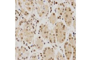 Immunohistochemistry of paraffin-embedded human stomach using BMI1 antibody at dilution of 1:200 (x400 lens).