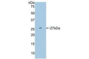 Detection of Recombinant MMP11, Human using Polyclonal Antibody to Matrix Metalloproteinase 11 (MMP11)