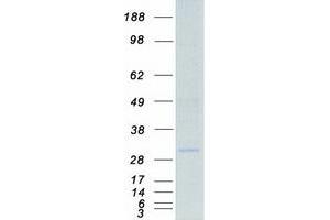 Validation with Western Blot