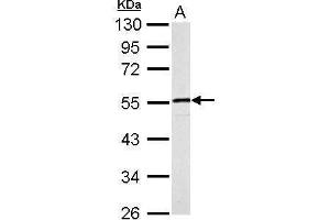 WB Image Desmin antibody detects DES protein by Western blot analysis.