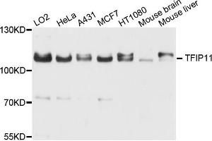 Western blot analysis of extract of various cells, using TFIP11 antibody. (TFIP11 anticorps)
