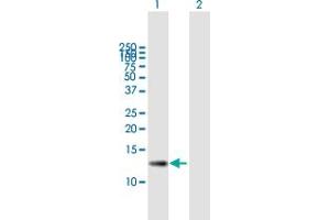 Western Blot analysis of ZSWIM7 expression in transfected 293T cell line by ZSWIM7 MaxPab polyclonal antibody. (ZSWIM7 anticorps  (AA 1-140))